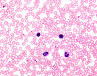 RAPID STAINING OF BLOOD SMEAR SOLUTION 2